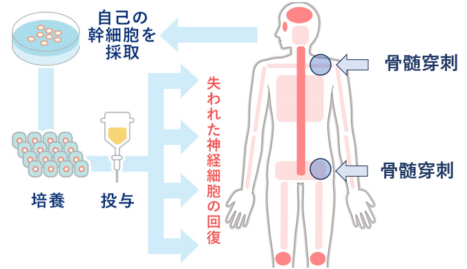 間葉系幹細胞のイメージ画像