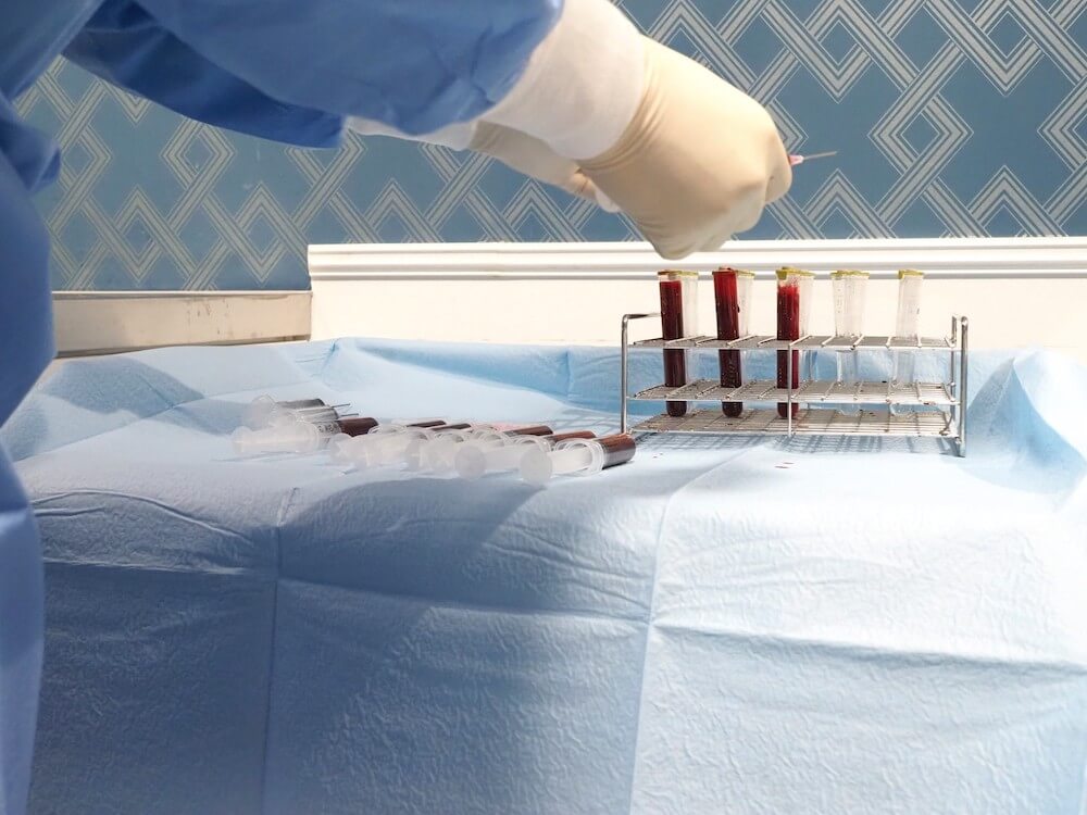 脊髄損傷の後遺症に期待できる効果のイメージ画像