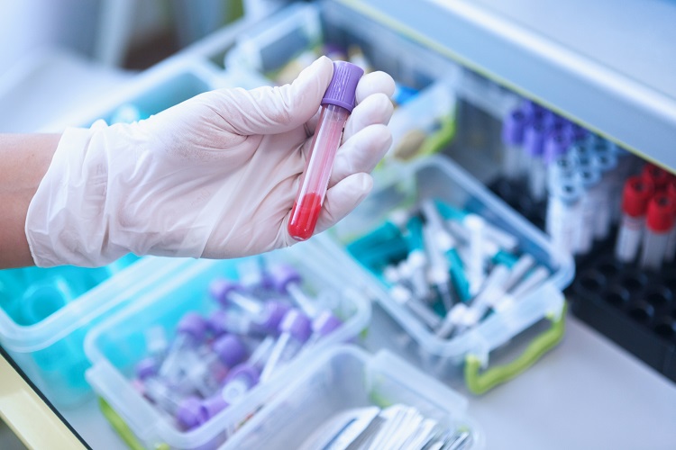 感染症検査のイメージ画像