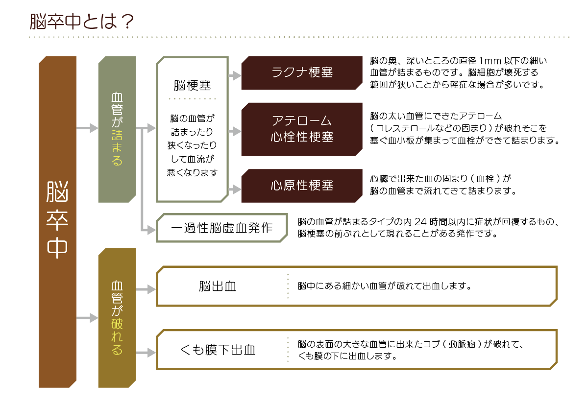 脳卒中について
