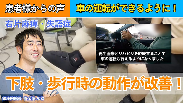 【40代男性｜脳出血・失語症】下肢に驚きの改善あり！杖なしでの安定した歩行や階段の上り下りが可能になりました！