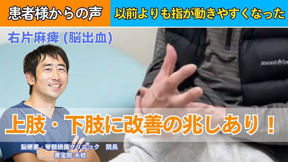 【60代男性｜脳出血】車いすからの回復！上肢・下肢ともに改善がみられました！