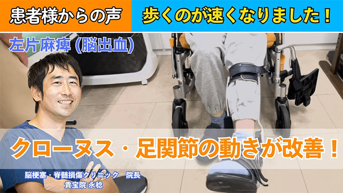 【40代女性｜脳出血】痙性が減って歩く量やスピードもアップしました！